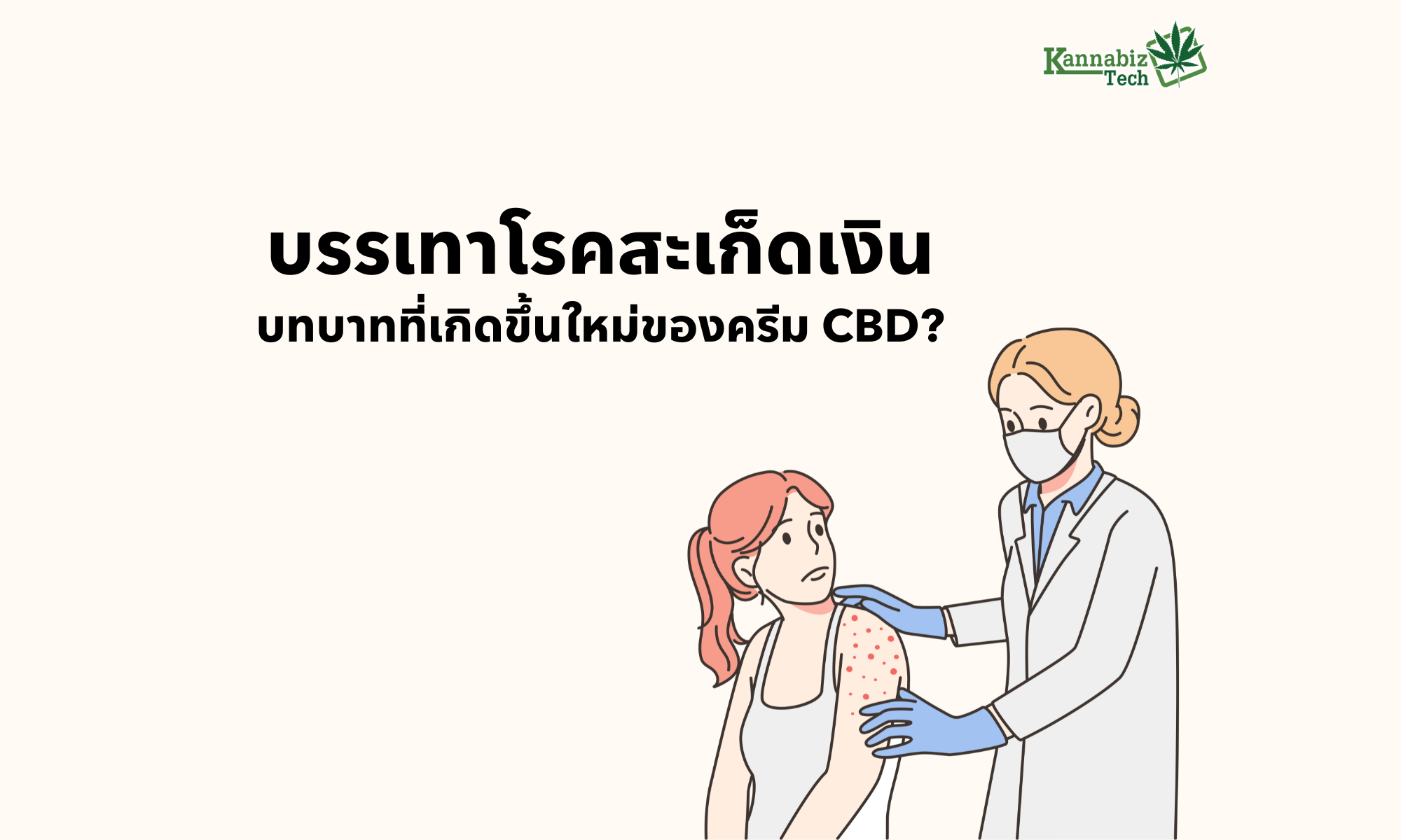 psoriasis relief